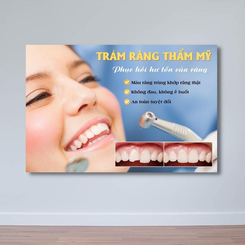 Tranh nha khoa "Trám răng thẩm mỹ" | Tranh nha khoa đẹp W9074 Tranh nha khoa "Trám răng thẩm mỹ" | Tranh nha khoa đẹp W9074