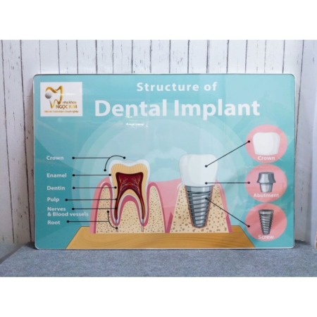 In ảnh Gỗ Số Lượng Lớn, ảnh Gỗ Tráng Gương để Bàn Giá Rẻ